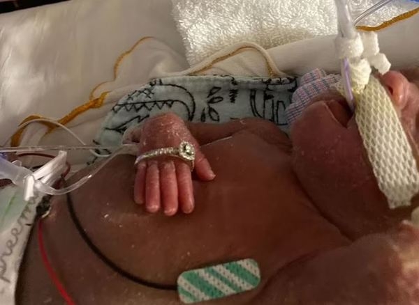 James的體型非常小,一枚戒指足以圈住他的四隻手指。