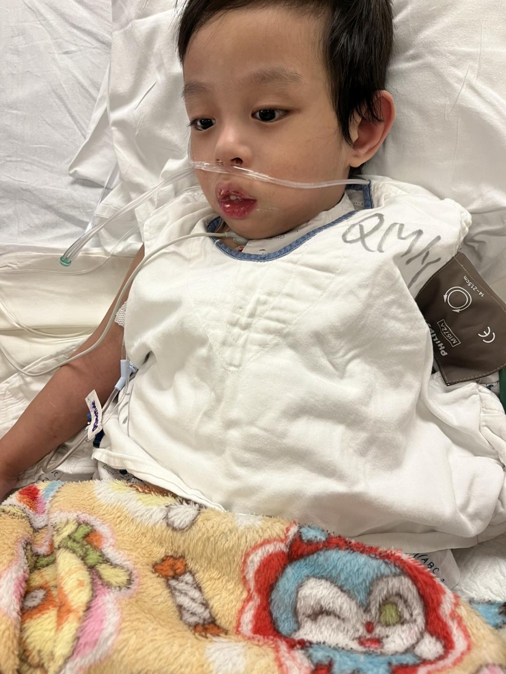 7月6日媽媽發文表示,信信要再緊急手術通血管。