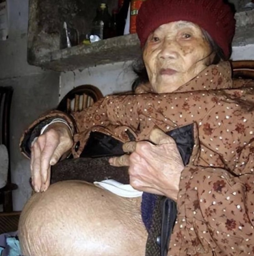 高齡懷孕離奇事件?該女子60年前懷了寶寶,但臨盆前胎兒不幸死亡。