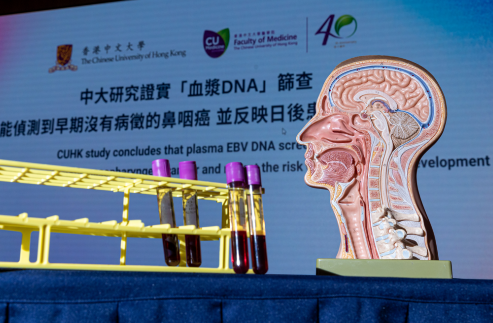 鼻咽癌檢測新發現!團隊相信這研究能應用於篩查幾十種癌症,目前仍在研究。