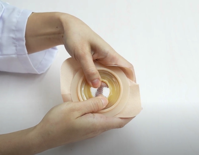 僅用手推出「可塑型底板」上的護養膠片,然後將已塑造好的造口形狀貼在造口上,每次更換造口袋便可。