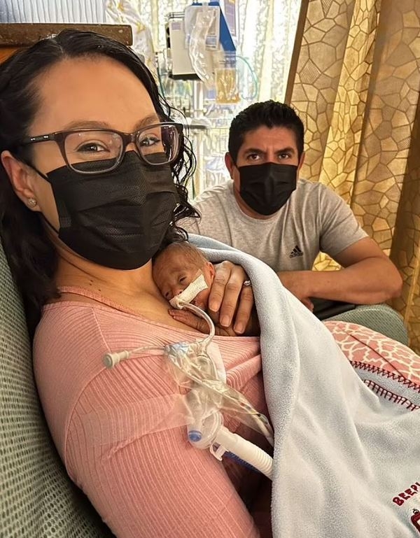 媽媽成功生下僅22週大的男嬰James。