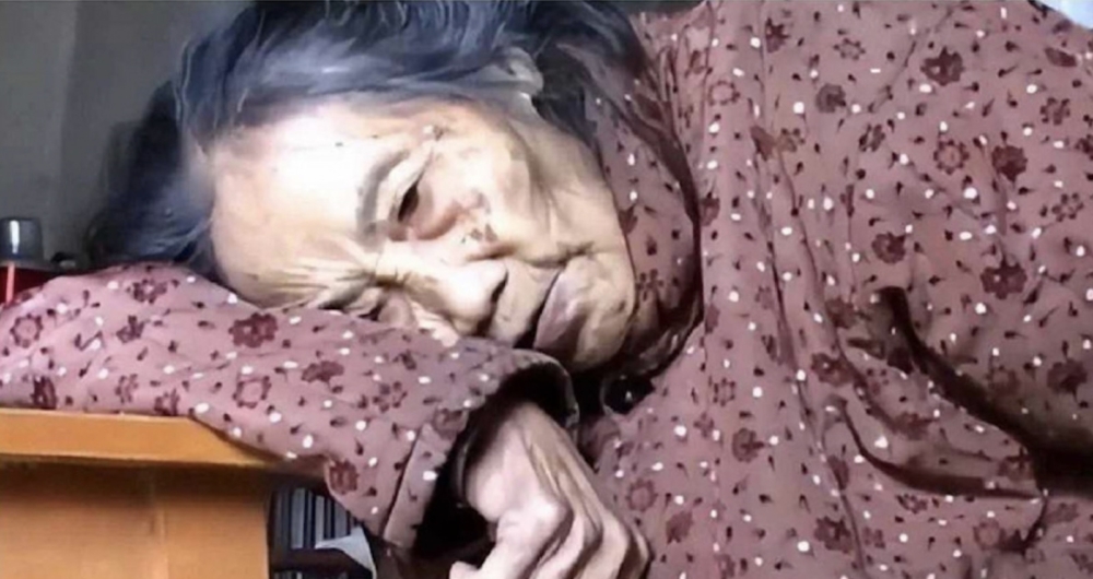 內地四川一名高齡91歲的老婦摔倒後出現「孕吐」症狀。