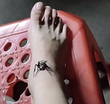 嫲嫲老房子外抓了一隻蜘蛛,放在孫女的小腿傷口上進行「吸毒」。