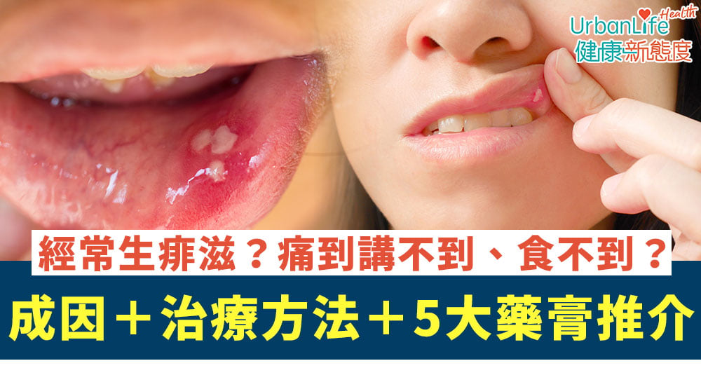 【痱滋膏推介】經常生痱滋痛到食不到飯?成因+5大藥膏推介