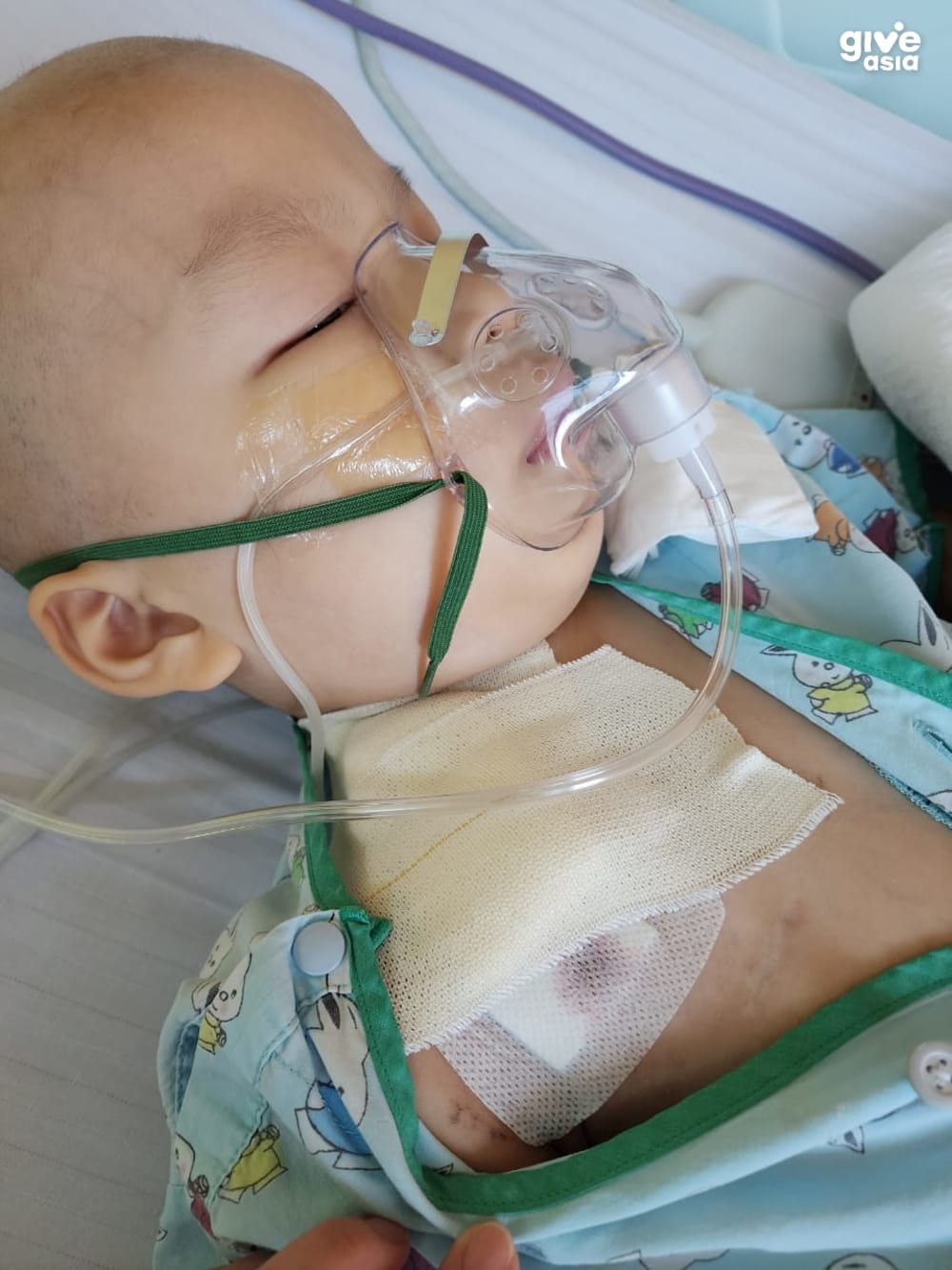 今年7歲的男童吳泓昌於3歲時因臉上淤青不散與持續發燒,到醫院驗血後被發現患上急性淋巴細胞性血癌。