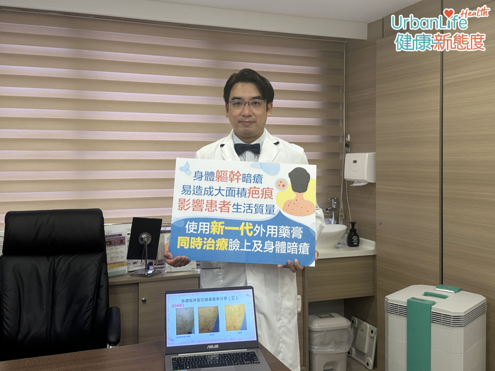 皮膚及性病科專科醫生陳湧指,目前的治療方式包括抗生素、口服避孕藥、維A酸,亦較難同時應對臉部及身體暗瘡。不過,近年發現新型外用藥膏能夠有效達致消炎及抑制粉刺的作用,可同時適用在臉上及身體軀幹部位的患處,患者在使用約兩周後有明顯改善。