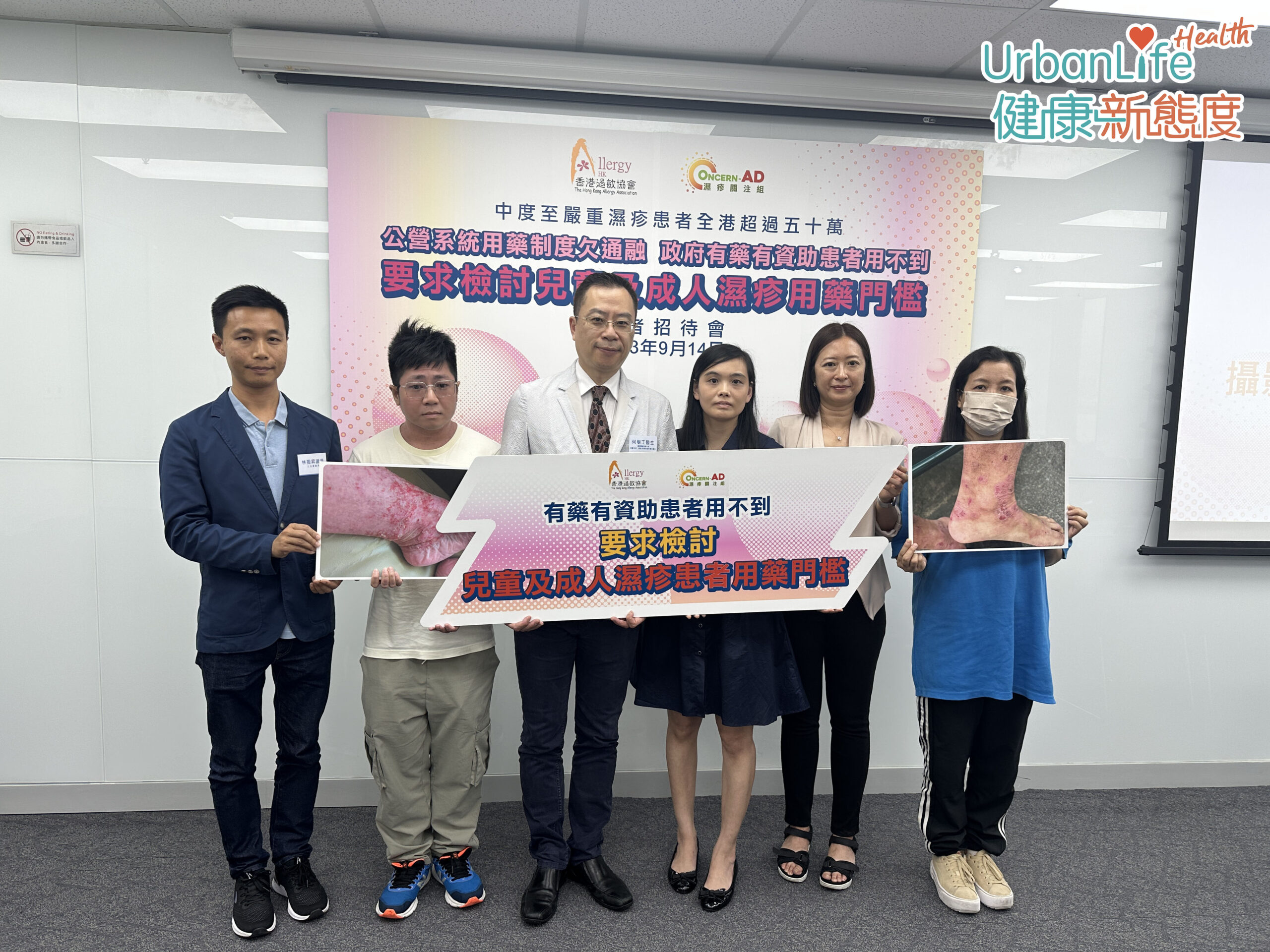 每年9月14日是世界濕疹日,異位性皮膚炎(濕疹)在香港十分普遍,每5人便有1人在不同時期患有濕疹,估計現時全港逾50萬人患中度至嚴重濕疹