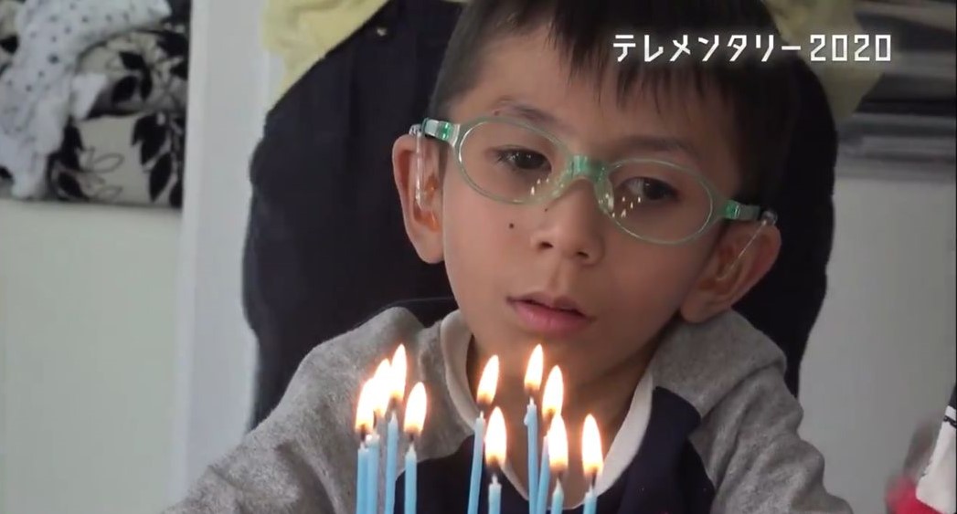 日本宮城縣16歲男童須知譽在4歲時被診斷出患有罕見病「柯凱因氏症候群」,又被稱為「類早老症」。