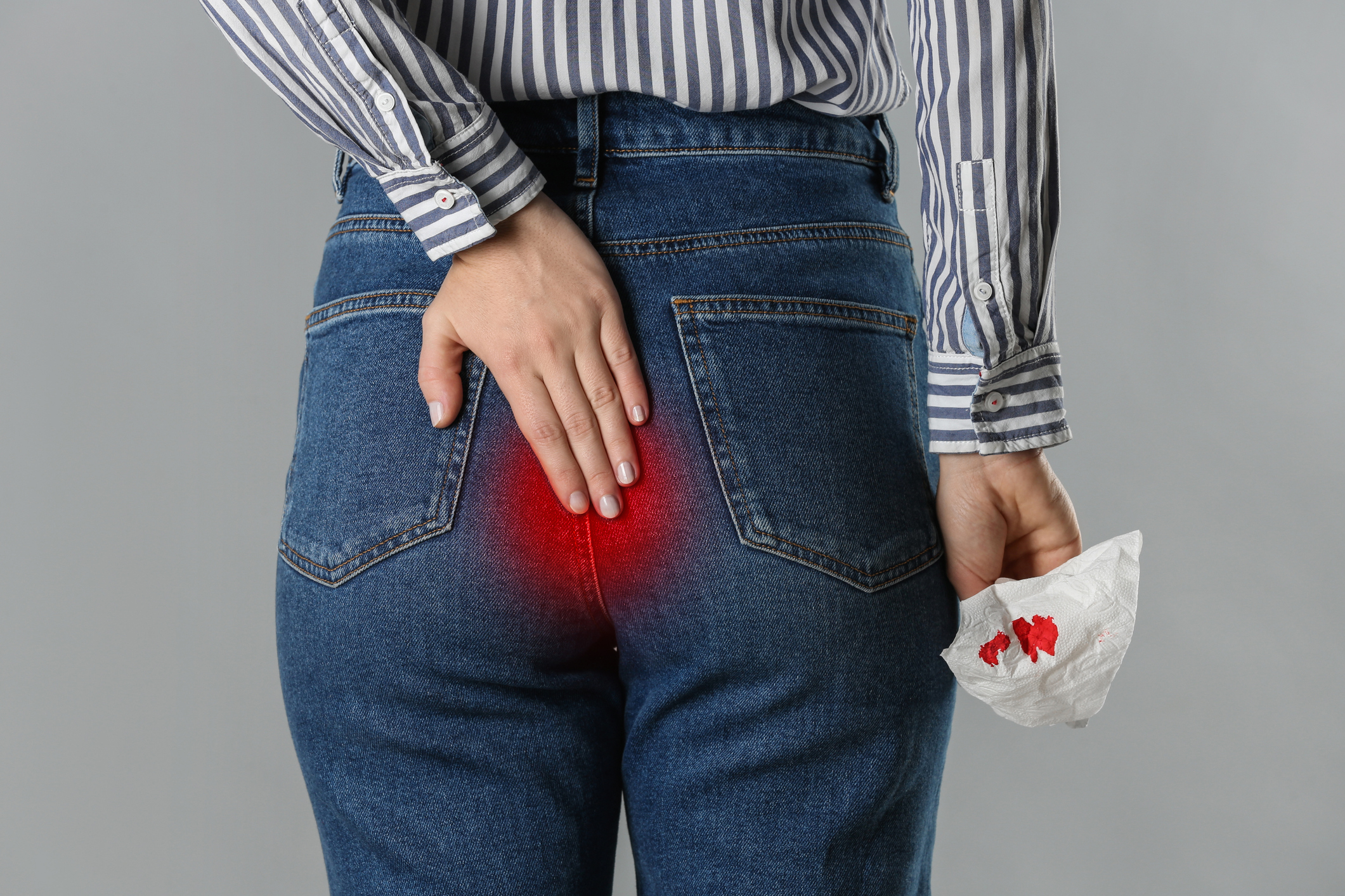 大腸癌與痔瘡從血便型態看疾病。