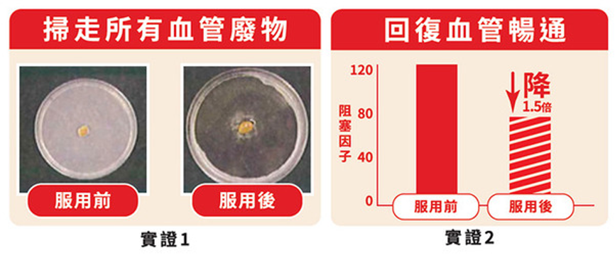 日本人每天吃納豆保持血管健康，納豆所蘊含的納豆激酶是讓血管暢通的天然成份，世界多項研究^已證實納豆激酶的功效。