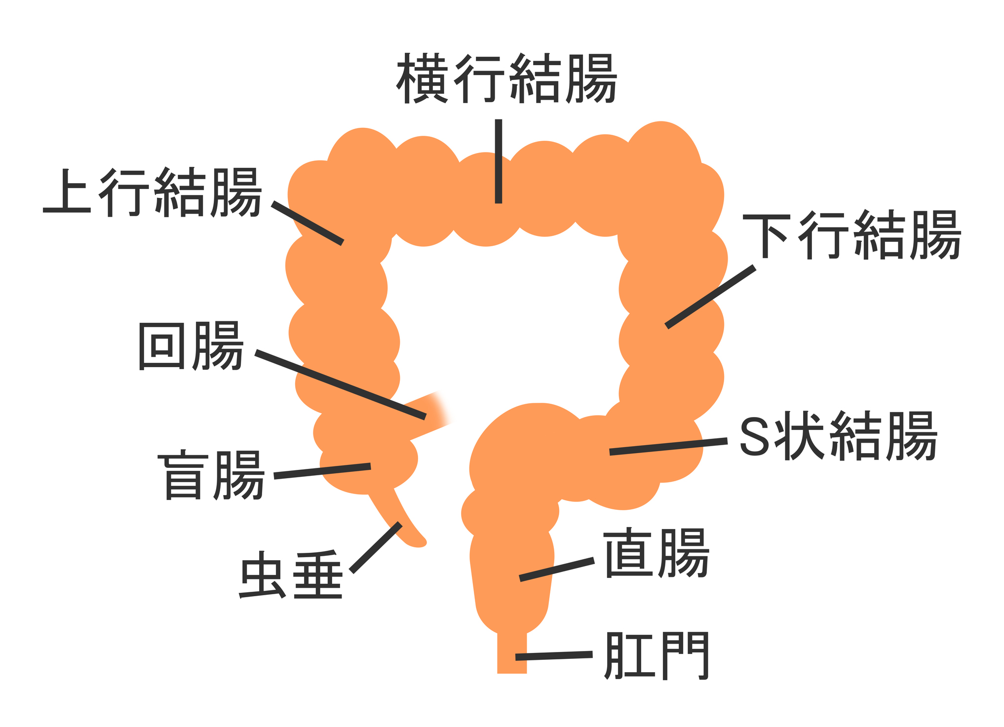 大腸癌主要分為三大類,如結腸癌、直腸癌以及大腸直腸癌,由於種類的不同,其發病位置、症狀表現與治療方式亦存在差異。