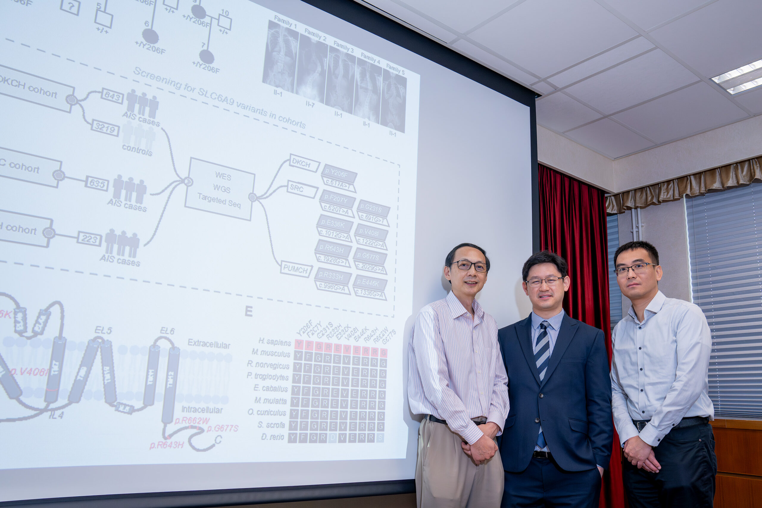 港大研究團隊最新發現,原發性脊柱側彎主要成因,是「SLC6A9 基因」的出現變異,令神經訊號的傳遞和協調中斷,以及負責步行或呼吸等自主行為的「中樞模式發生器」失調,有關研究已在學術期刊《臨床研究期刊》發表。
