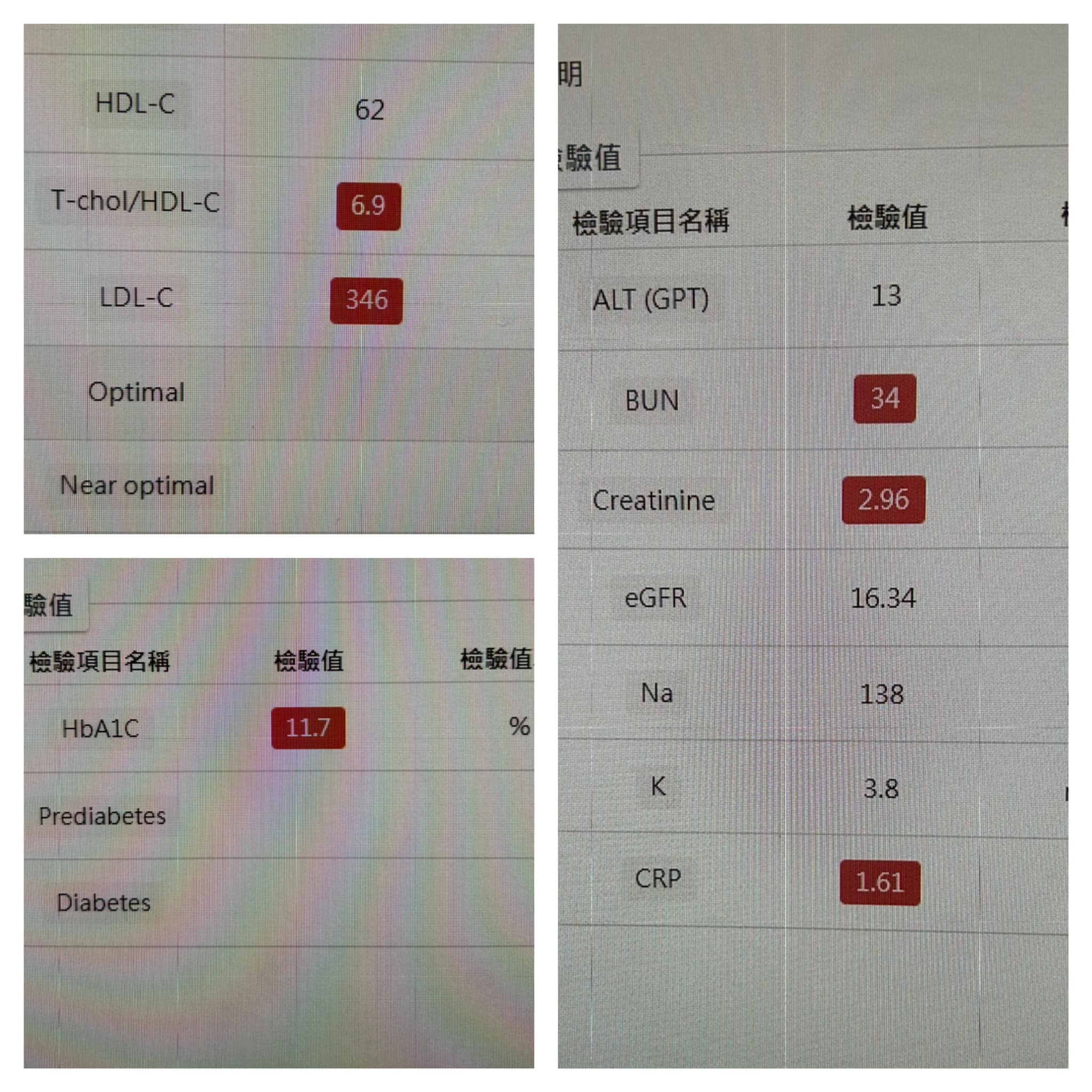 醫生發現她的低密度脂蛋白（LDL）高達346mmHg，令醫生表示「應該是我進心臟科這13年來看過最高的」。