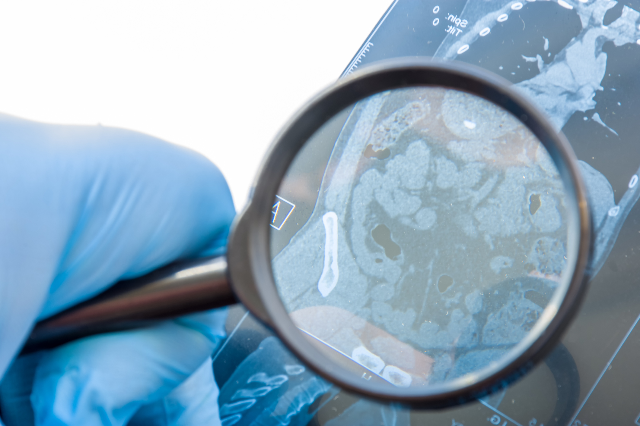 以下幾種習慣預防措施盡量多做,就可以提供更有效地預防和健康管理。