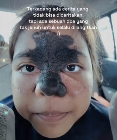 母親欲通過分享女兒的故事,帶出這個社會上應該保持接受每個人的缺點,以及勇於接受自己不完美之處的美德。