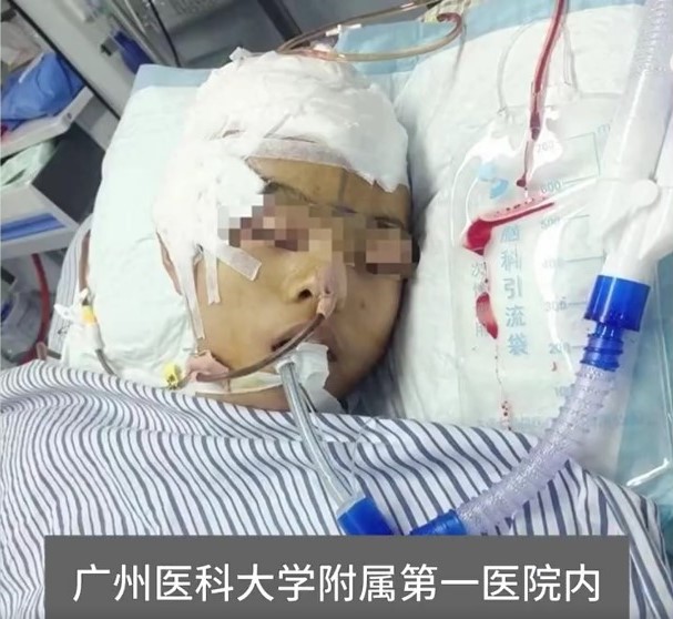 送醫後陷入昏迷,醫生發現其腦部被毆打至腦疝以及腦出血,在經歷19日的搶救行動後,於12月23日被判定腦死。