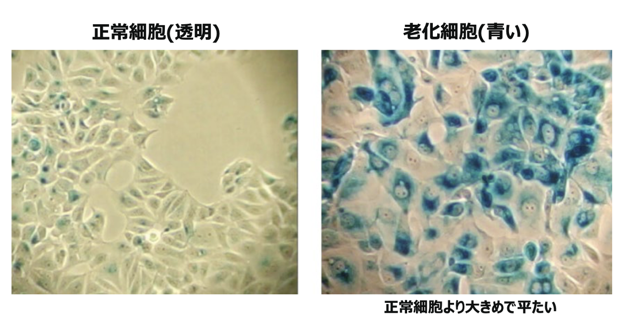 「喪屍細胞」産生老化因子 SASP 加速身體衰老。