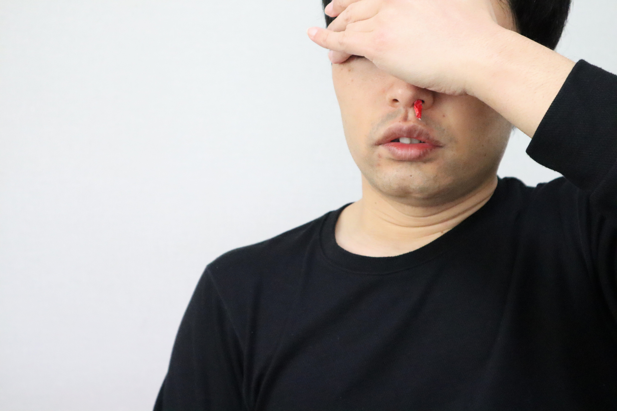 事主描述「我開始流鼻血,經常流鼻血,我甚至無法起身去洗手間,鼻子就開始流血。」