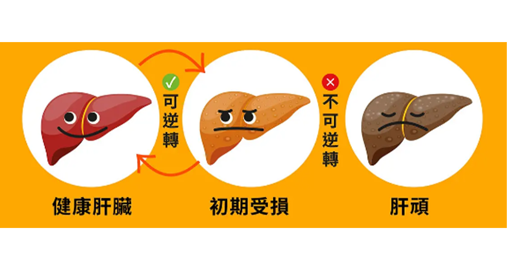 肝臟受損初期,病徵不明顯,如果面色出現一些異常,例如面色暗沉、膚色泛黃、眼睛發黃、能力下降,便要留意了!