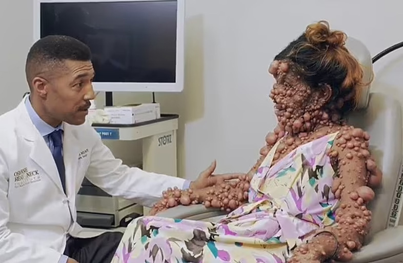 為了治療這個疾病,她不惜飛往美國接受了洛杉磯頭頸外科腫瘤學家Ryan Osborne的治療。