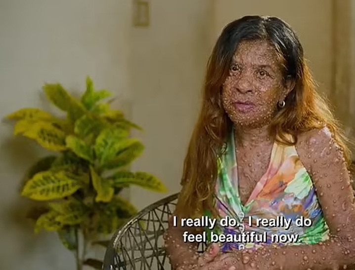 在完成治療後,Charmaine十分滿意現狀,她認為自己的生活完全的改變了,能自主走路,也能與孫女一起玩耍。