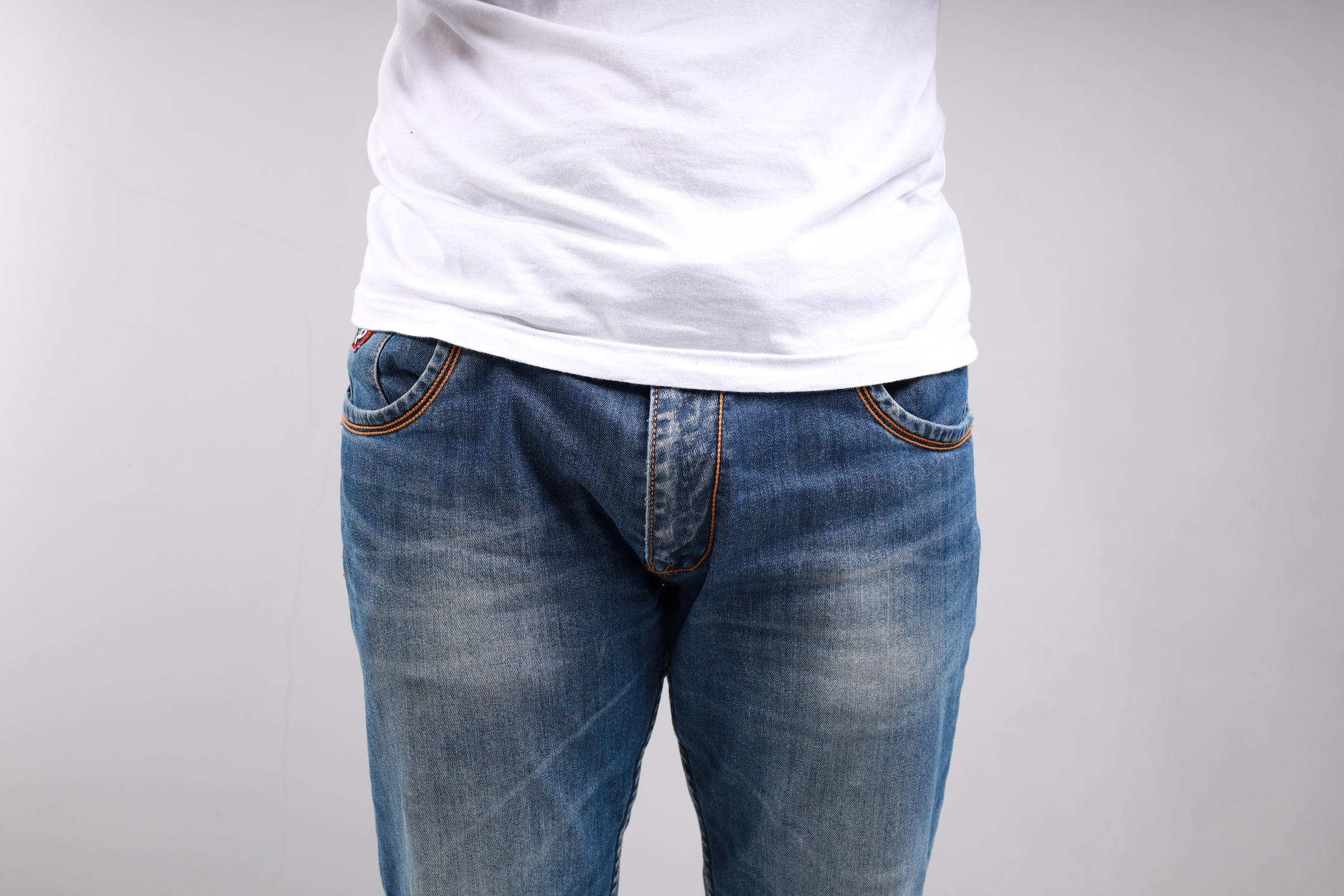 包皮過緊過窄,令龜頭難以露出清洗,醫學上稱之為「包莖」,由於有機會引起其他疾病或發炎,醫生會建議進行割包皮手術。