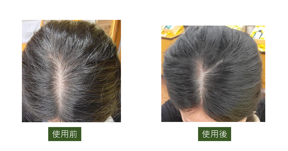 真實男、女用家表示,使用L'Occitane草本療法防掉髮頭皮護理精華後,脫髮問題明顯得到改善,稀疏位置變得濃密。