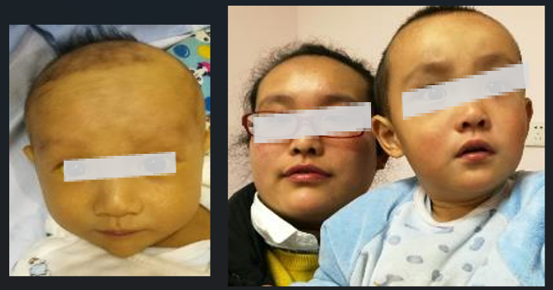 使用藥物有助改善病童的生活質量