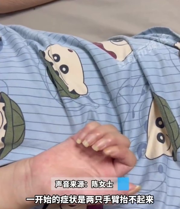 起初她發現自己兩隻手臂突然抬不起來,本來以為是肩周炎這類普通的疾病,所以沒有太在意,直至後來發展成生活不能自理,才前往就醫,結果被診斷為運動神經元病。