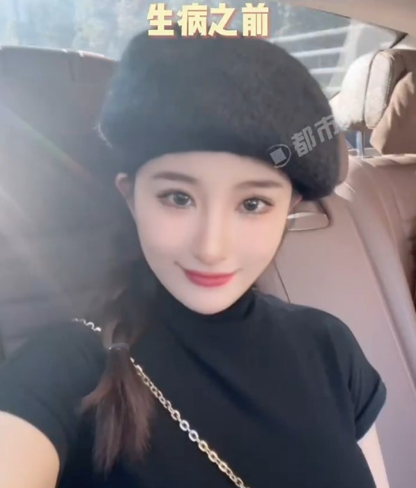 内地一名26歲女子小陳(化名)突然患上「漸凍人症」