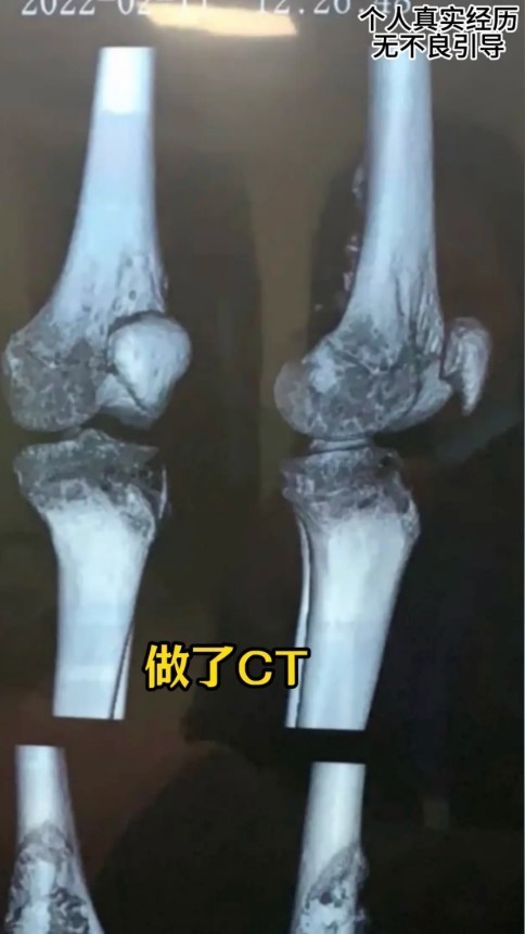 王子晟已於2月16日早上在老家去世，結束了三年的抗癌旅程