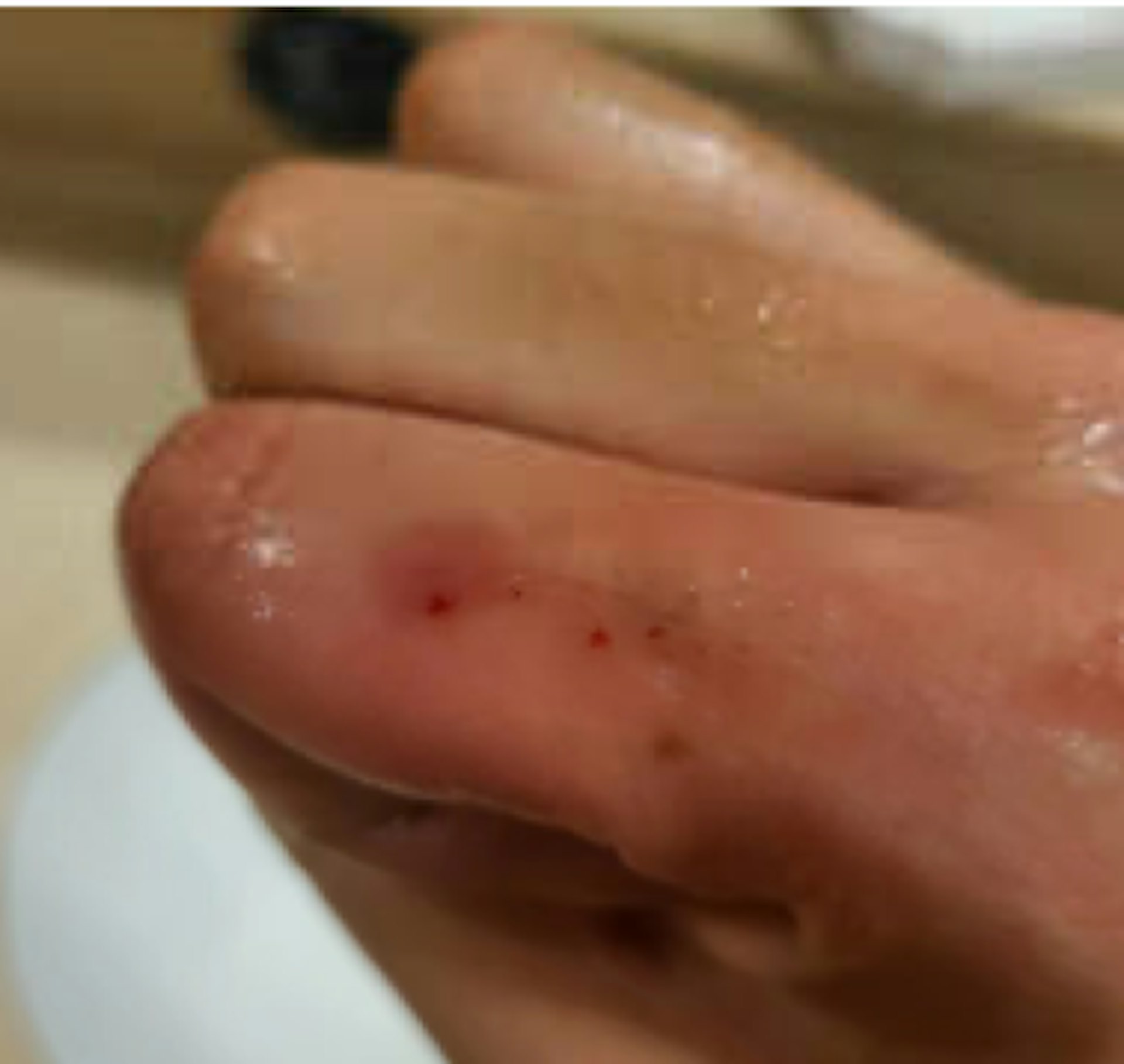 香港中毒控制中心去年接獲70宗被蛇咬的求診個案,當中有5宗是被非本地寵物蛇咬傷。