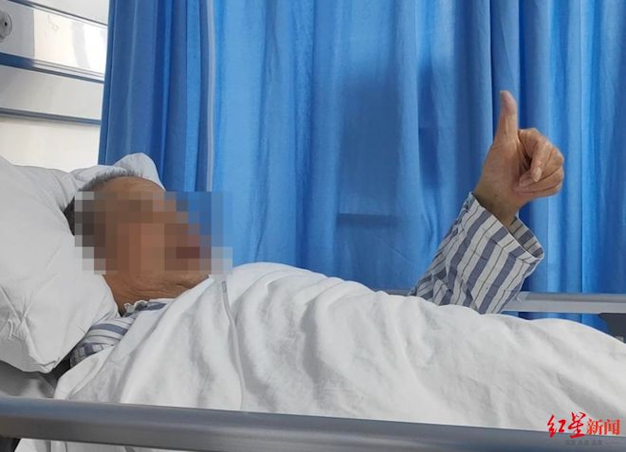 院方表示，王爺爺腎功能正常，雙下肢的水腫也已完全消退。醫護團隊根據DeepSeek系統提供的康復計劃指導患者進行功能訓練。由於術前準備充分、術後管理得當，患者恢復順利，預計不久後即可康復出院，重返日常生活。