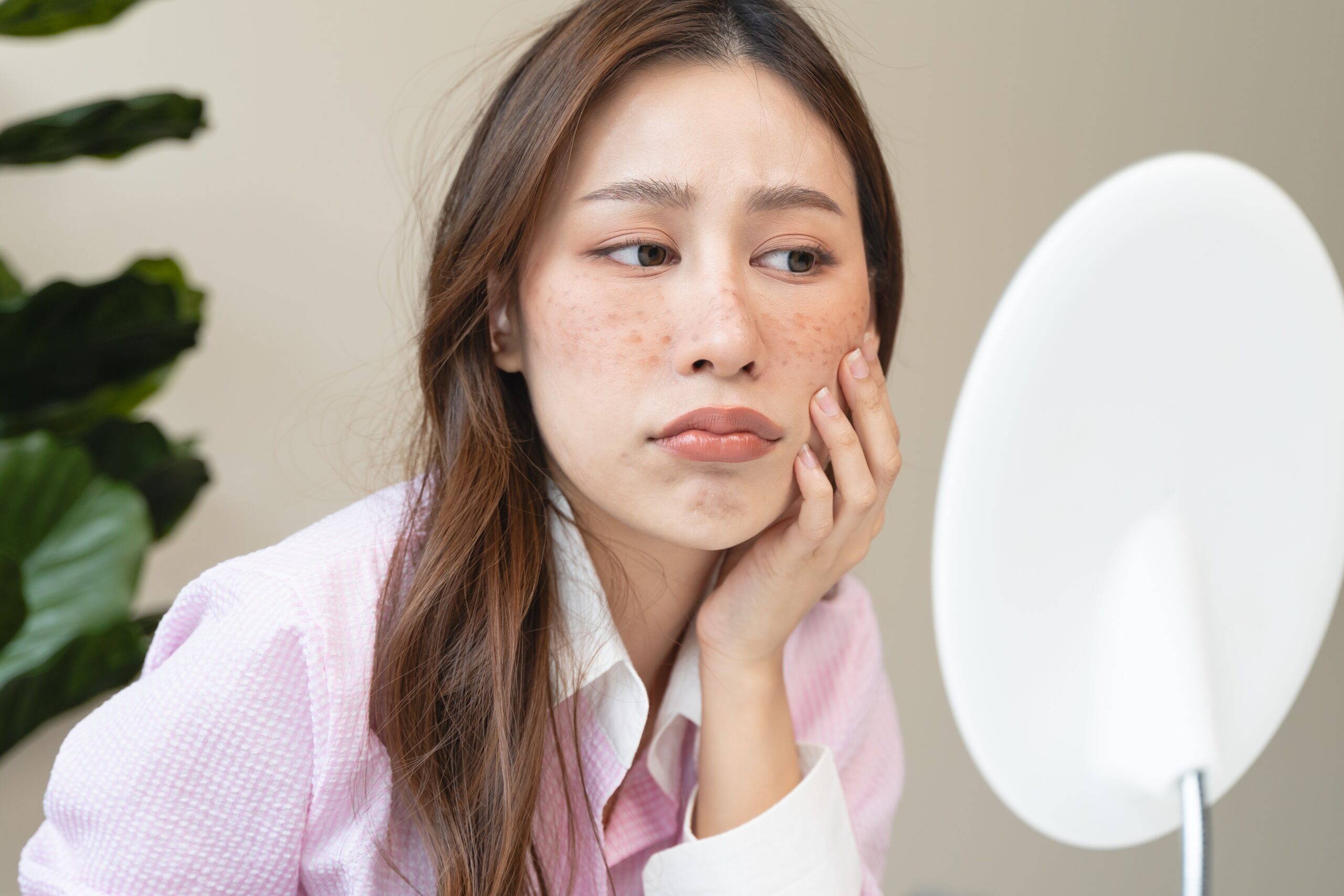 有些人的膚質和生活習慣會更容易長斑,其中5類人特別會受到色斑影響!