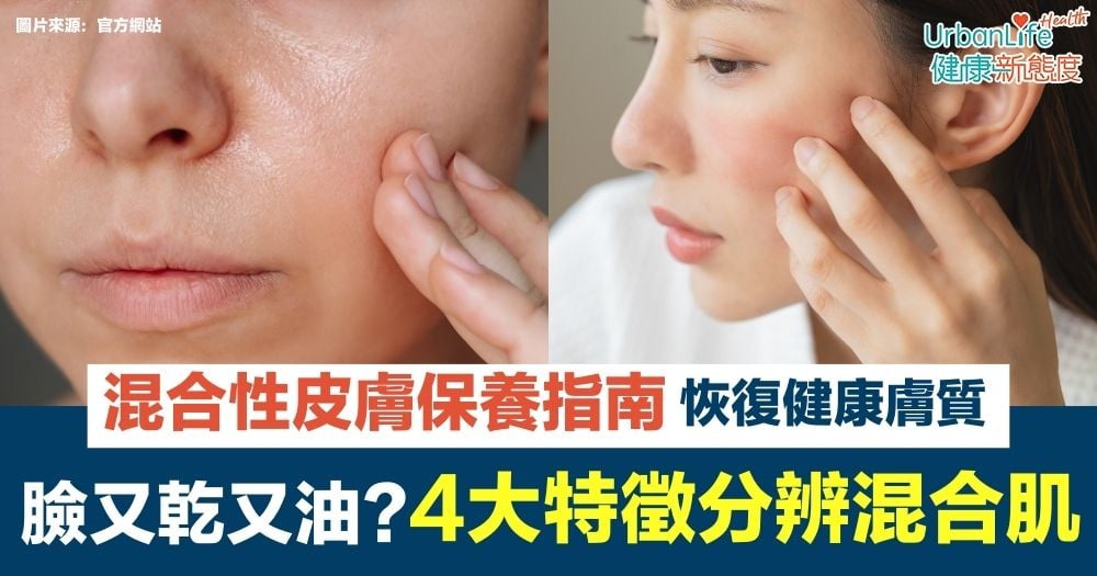 【癬種類】真菌所致?出汗多易生癬?乾癬、汗癬等7大皮膚癬分類