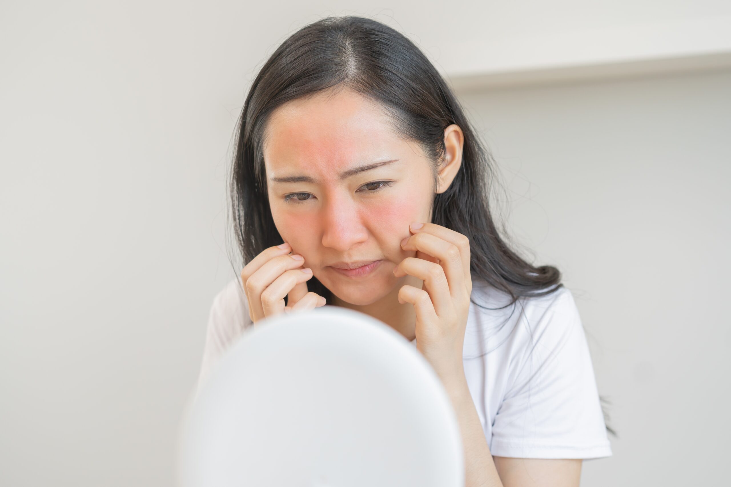 懷孕期間，女性體內的荷爾蒙劇烈變化，皮膚狀況也隨之改變。