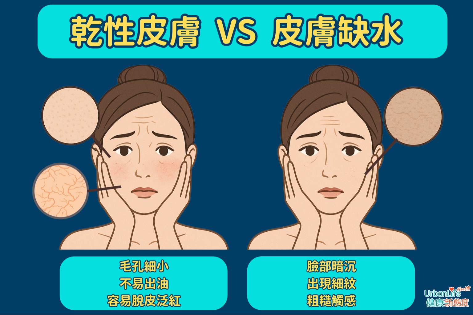 如果感覺皮膚乾燥，必須分清楚是乾性肌還是缺水肌才能對症下藥