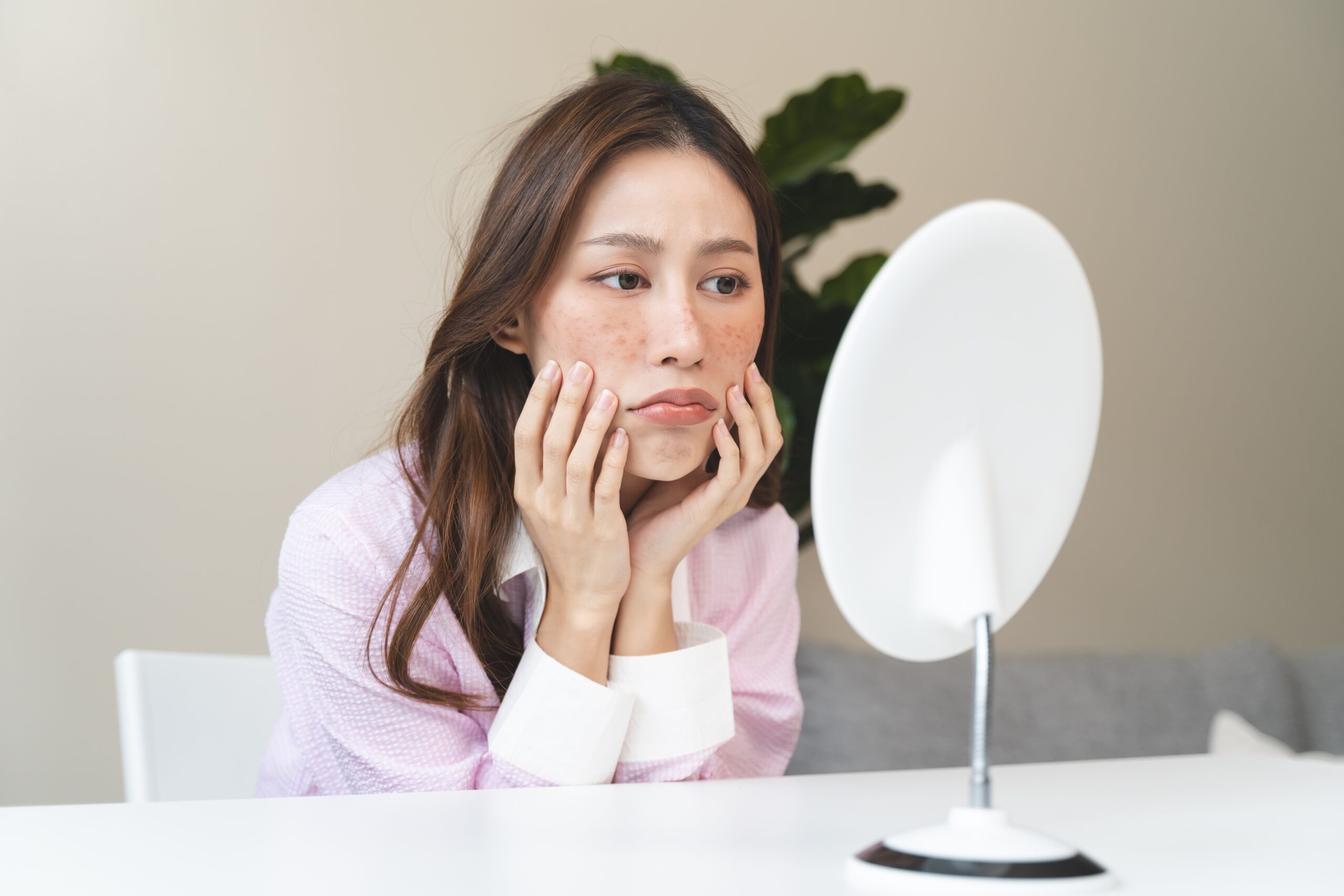 皮膚一旦形成了明顯的黑色斑點,通常不會完全自行消失,尤其是日曬斑和肝斑在不處理的情況下可能持續存在甚至變多。