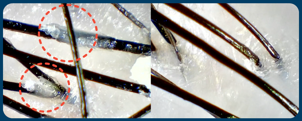 （左）在顯微鏡下，即使頭皮表面清潔，仍有油脂污垢依附於毛囊內或髮根上。 （右）深層清潔後，頭皮及髮根即時變得乾淨。 