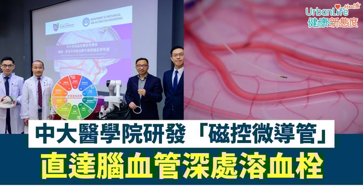 【中風救星】中大醫學院研發「磁控微導管」!直達腦血管深處溶血栓、準確率更高更安全