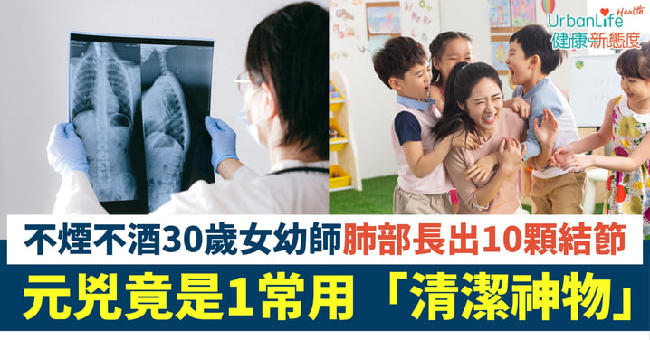 【肺炎】不煙不酒30歲女幼師肺部長出10顆結節!元兇竟是常用「清潔神物」?