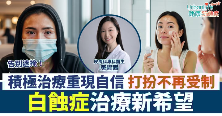 積極治療重現自信 打扮不再受制 白蝕症治療新希望
