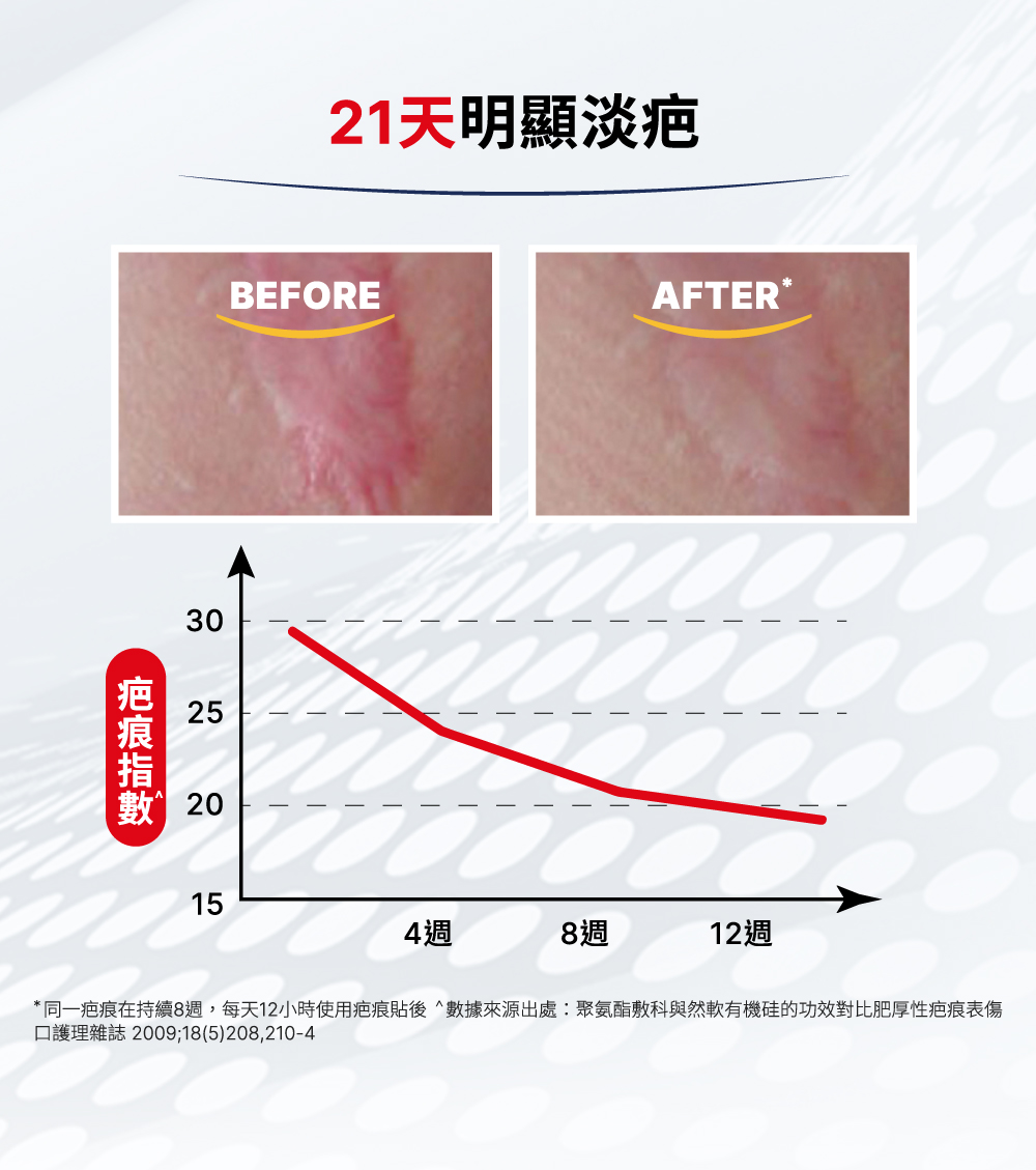 使用Elastoplast易理妥褪疤貼3星期,疤痕迅速撫平、淡化、軟化凸起及帶紅組織,新舊疤痕適用,效果明顯。