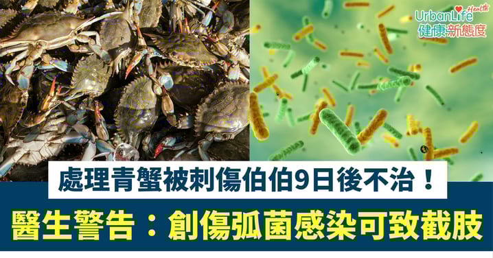【致命惡菌】處理青蟹被刺傷伯伯9日後不治!醫生警告:創傷弧菌感染可致截肢、敗血性休克