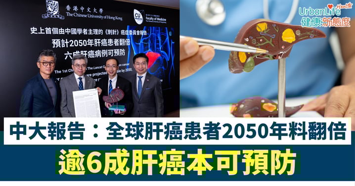 【肝癌預警】25年後全球患者恐翻倍!中大領導《刺針》報告:逾6成肝癌本可預防、3大元兇要警惕