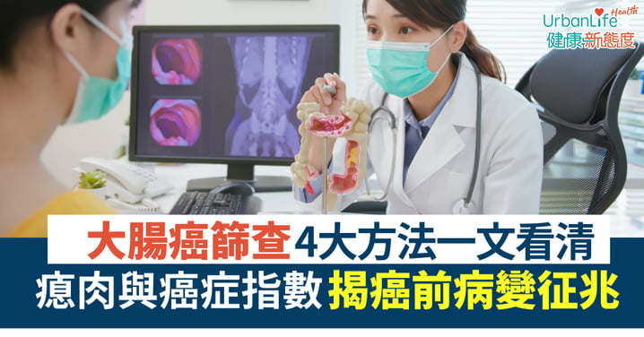 【預防癌症】大腸癌檢查全攻略:解讀瘜肉與癌症指數的關鍵真相