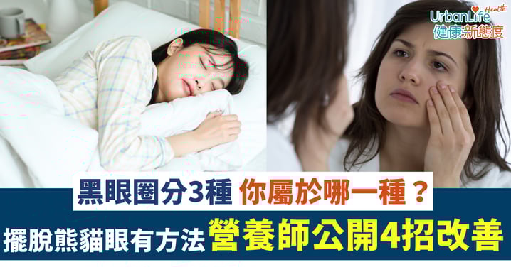【擺脫熊貓眼】黑眼圈分3種 你屬於哪一種？營養師公開4招改善