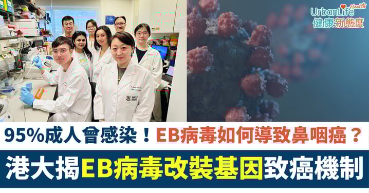 【鼻咽癌治療】95%成人曾感染!港大揭EB病毒「改裝基因」致癌機制、鎖定新療法方向