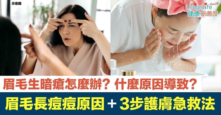 【暗瘡位置】眉毛生暗瘡怎麼辦？什麼原因導致？眉毛長痘痘原因＋3步護膚急救法＋解決方法＋其他位置暗瘡原因